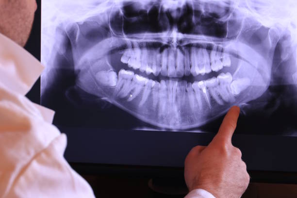 Best 24-Hour Emergency Dentist in Ferndale, CA
